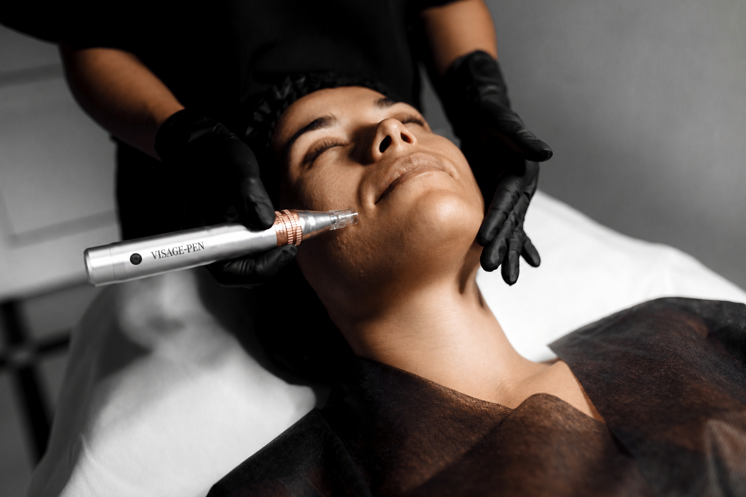 Microneedling tretman u studiju Visage Cosmetic