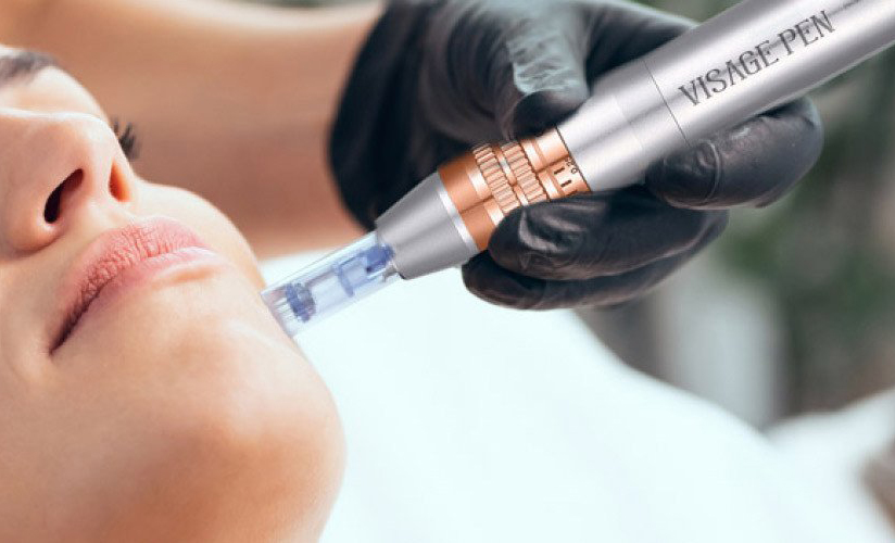 Microneedling Derma Pen