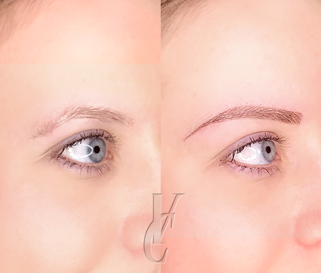 Microblading
